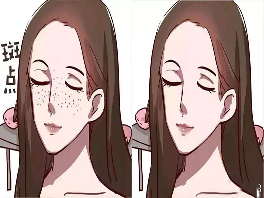 祛斑療程商標注冊哪一類？